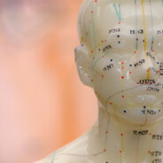 How can acupuncture help you?